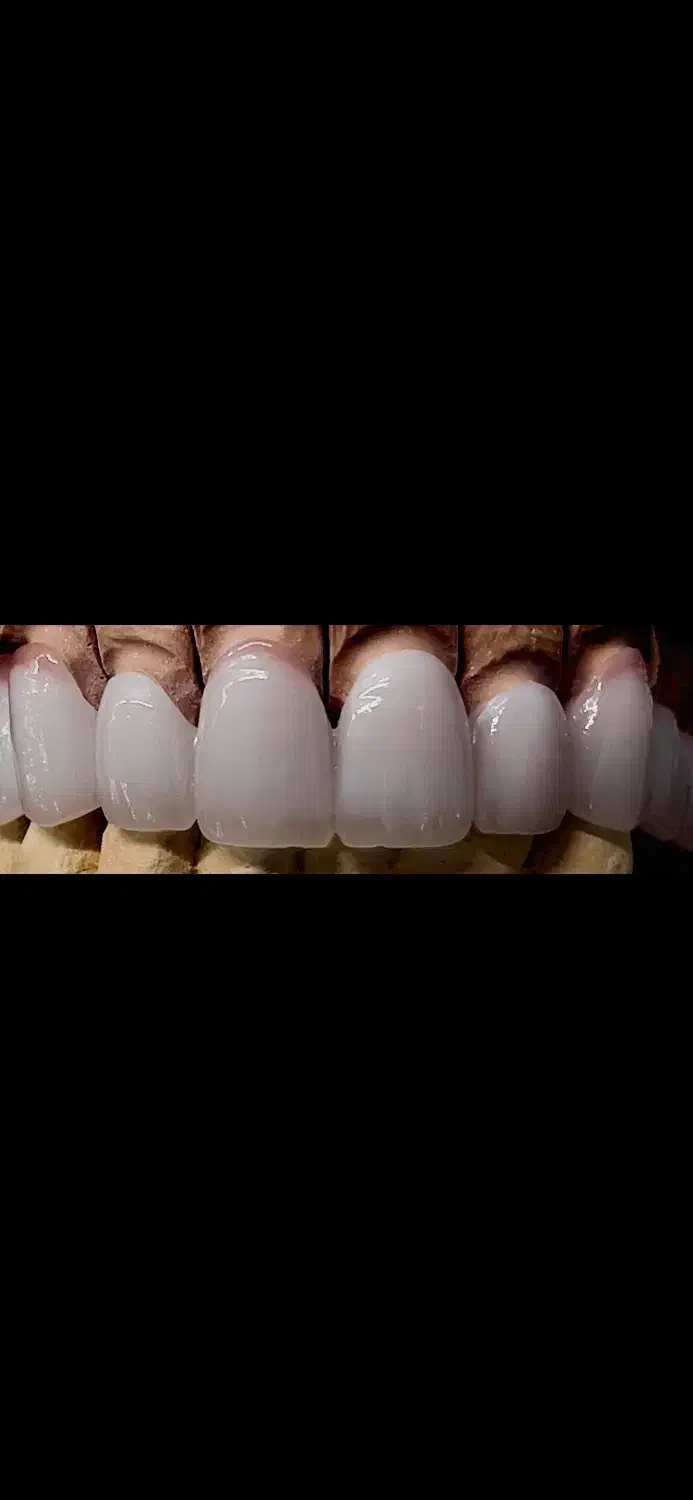 لابراتوار دندانسازی