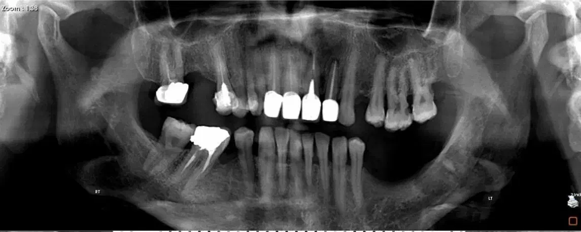 استخدام پذیرش دندانپزشکی